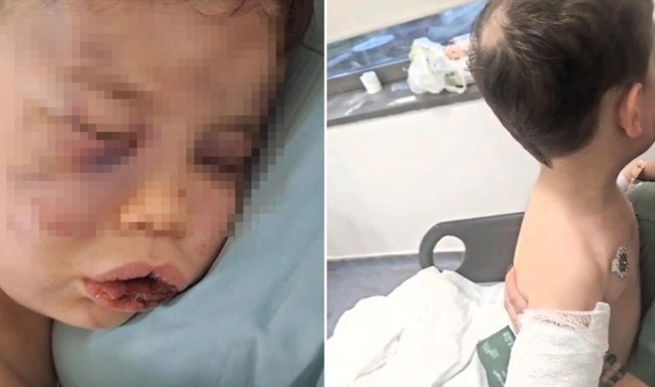 2 yaşındaki bebeğe vahşeti yaşattılar: Durumu kritik!