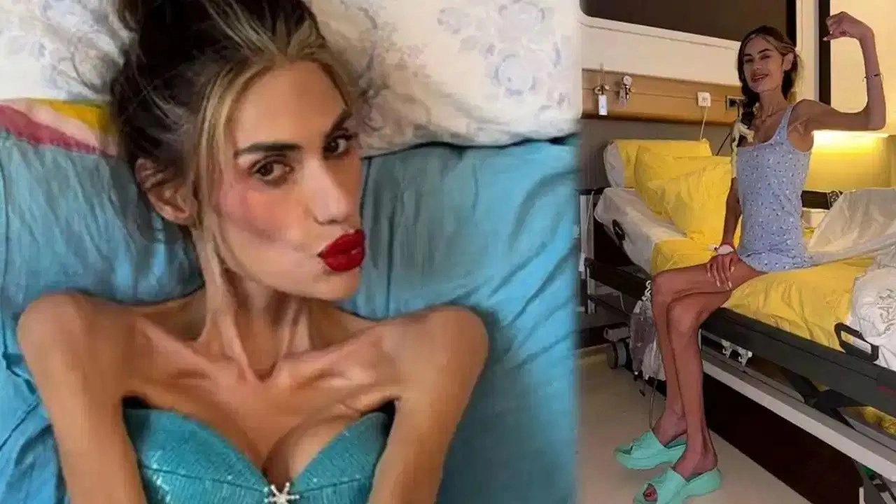 23 kiloya düşen Nihal Candan hayatını kaybetti
