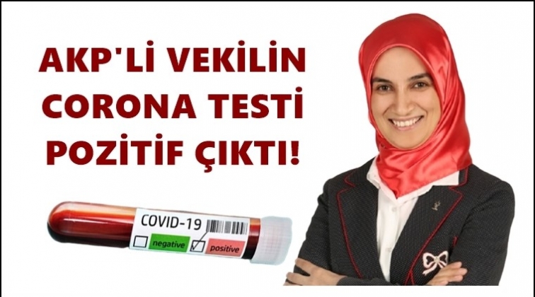 AKP’li vekilin corona testi pozitif çıktı!