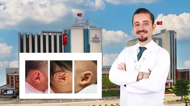 Ameliyatsız kulak şekillendirme