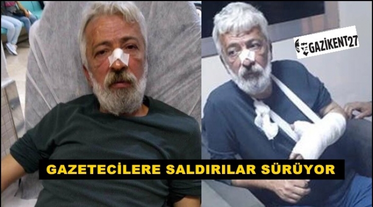 Bir gazeteciye daha saldırı...