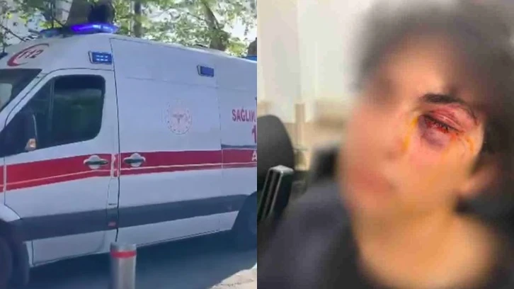 CHP standına saldırıp, 15 yaşındaki çocuğu öldüresiye darbettiler!