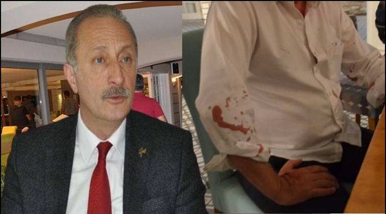 CHP’li belediye başkanına beyzbol sopalı saldırı!