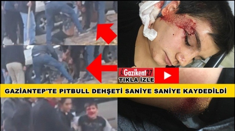 Gaziantep'deki pitbull dehşeti kamerada