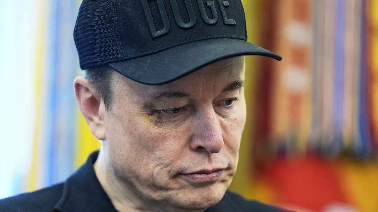 Gözündeki morluk dikkat çekmişti: Elon Musk nedenini açıkladı