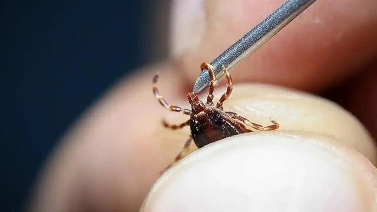 Hastaneye gitti... Karnına yapışan kene ile karşılaştı!