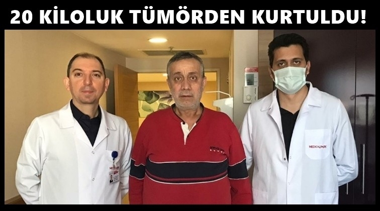 Karnından 20 kilogramlık tümör çıktı!