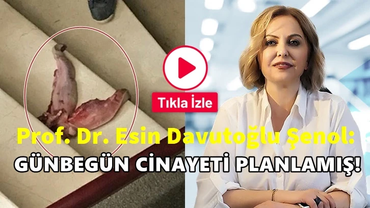 Prof. Şenol'un ofisinin önüne dana dili bıraktılar!