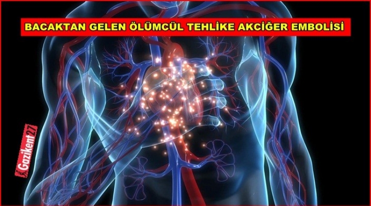 Akciğer embolisi, tehlikeli sonu&ccedil;lara sebep oluyor