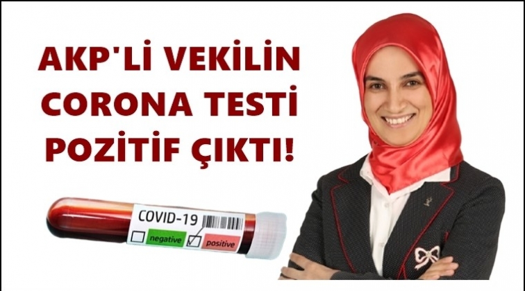 AKP&rsquo;li vekilin corona testi pozitif &ccedil;ıktı!