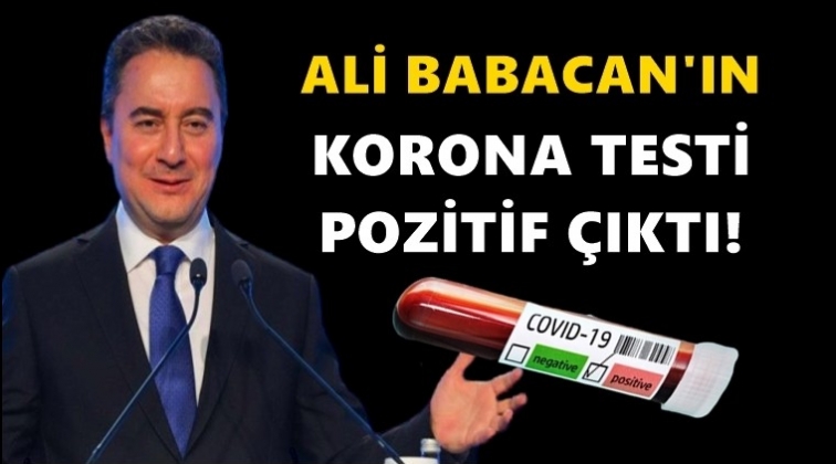 Babacan koronavir&uuml;se yakalandı!..