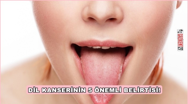 &lsquo;Basit bir aft&rsquo; deyip ge&ccedil;meyin!