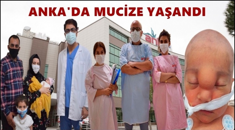 Beyni b&uuml;y&uuml;yen bebeğe ANKA&rsquo;da m&uuml;dahale