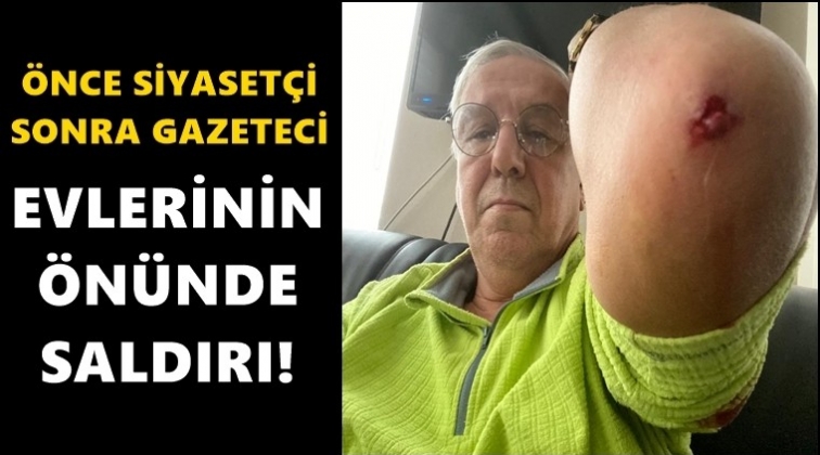 Bir saldırı daha... Bu kez gazeteci d&ouml;v&uuml;ld&uuml;!