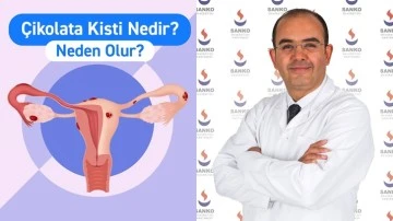 Çikolata kisti hastalığı nedir?