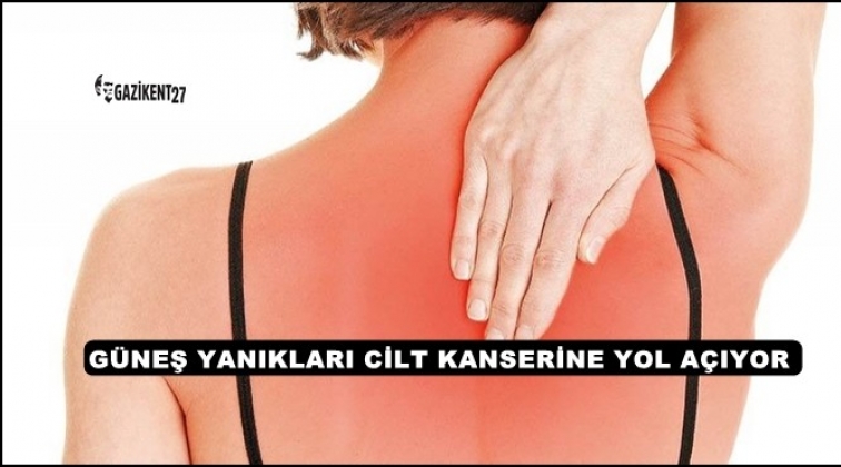 Dikkat! Cilt kanserine davetiye &ccedil;ıkarıyor...