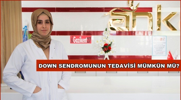 Down sendromluların fazlası var eksiği yok