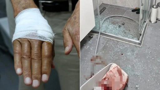 Duşa kabin camı patladı... Emekli akademisyen yaralandı!