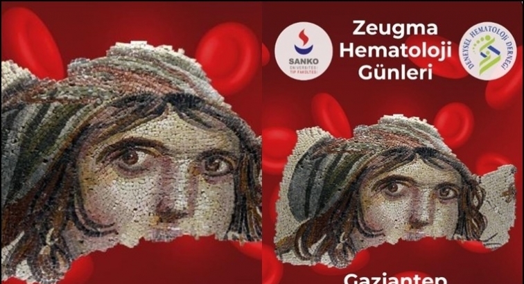 Gaziantep Zeugma Hematoloji G&uuml;nleri...