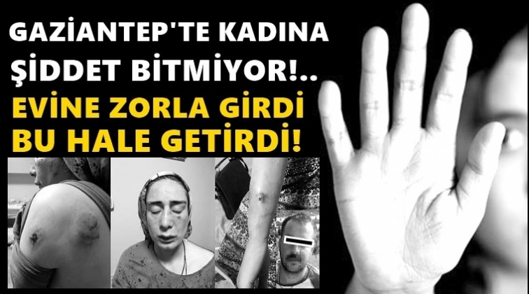 Gaziantep'te koca dehşeti!..