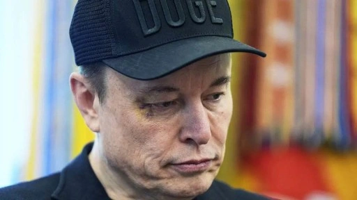 Gözündeki morluk dikkat çekmişti: Elon Musk nedenini açıkladı