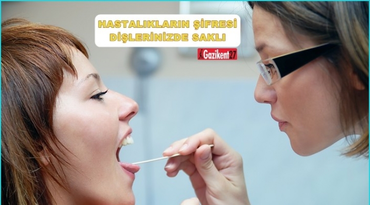 Hastalıkların şifresi dişlerinizde saklı