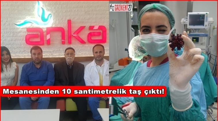 İdrarda kan varsa dikkat! 10 cm taş &ccedil;ıktı...