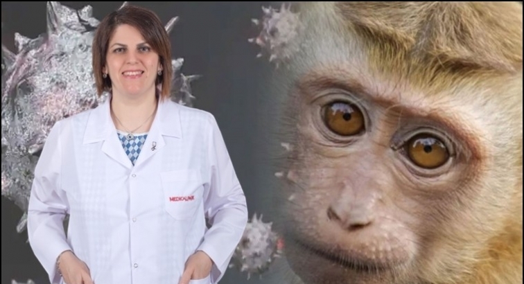 Maymun &Ccedil;i&ccedil;eği Vir&uuml;s&uuml; i&ccedil;in &ouml;nlemler...