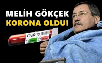 Melih G&ouml;k&ccedil;ek koronavir&uuml;se yakalandı...