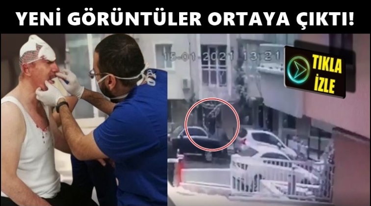 &Ouml;zdağ'a saldırı anının g&ouml;r&uuml;nt&uuml;leri ortaya &ccedil;ıktı