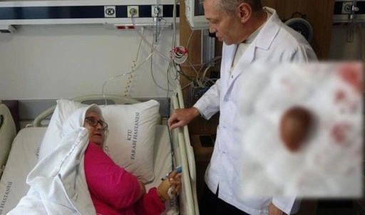 Soluk borusundan, akciğerine gitti: Yuttuğu 'karayemiş çekirdeği' az kalsın öldürüyordu!