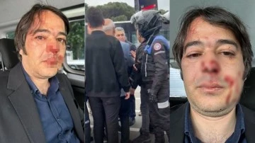 &Uuml;sk&uuml;dar'daki ka&ccedil;ak kafe yıkımında İBB İmar M&uuml;d&uuml;r&uuml; darbedildi!